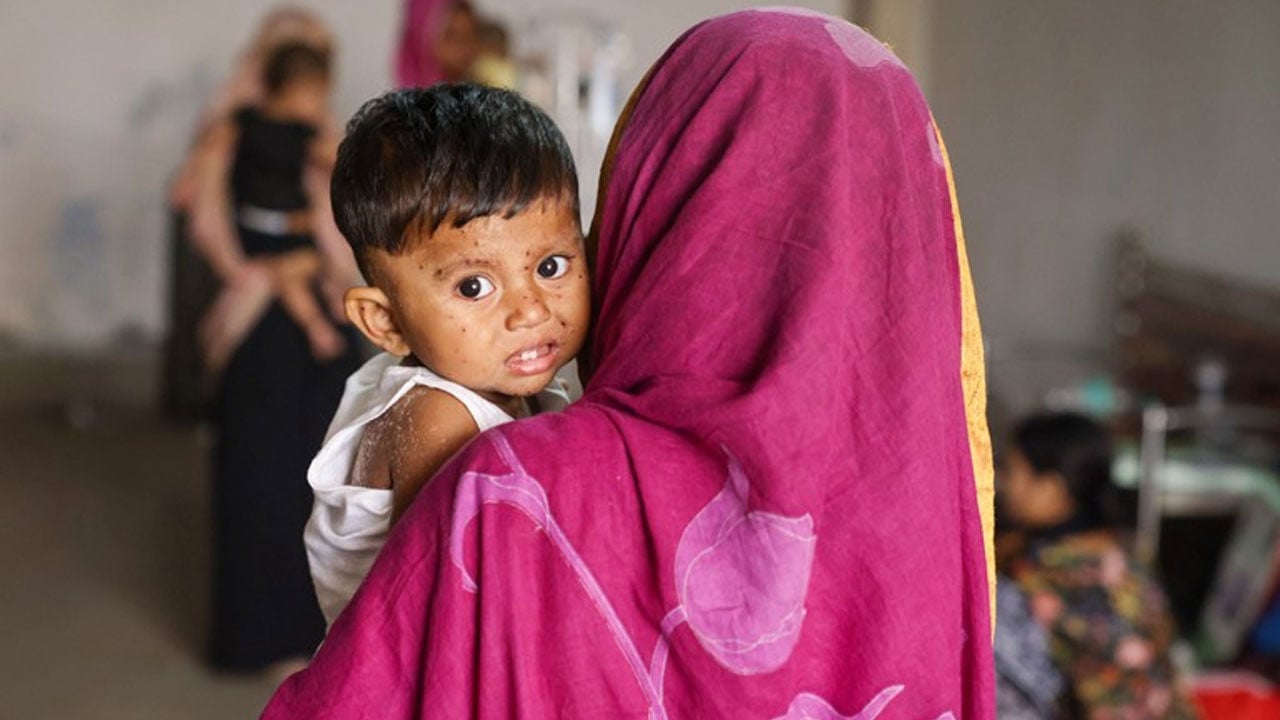 হাম ও উপসর্গে আরো ৭ শিশুর মৃত্যু